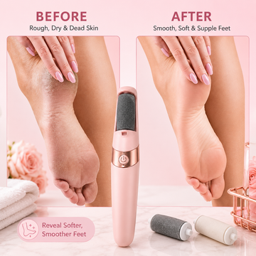 Electric Foot File Callus Remover Review UAE 2026: The Rechargeable Pedicure Tool Giving Dubai Women Salon Soft Feet at Home