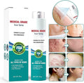 Medical Scar Removal Spray - Crown Cart