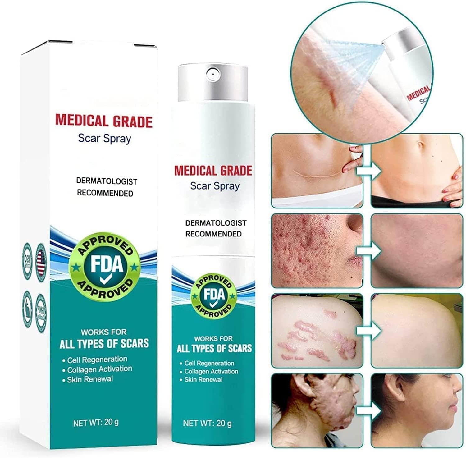 Medical Scar Removal Spray - Crown Cart