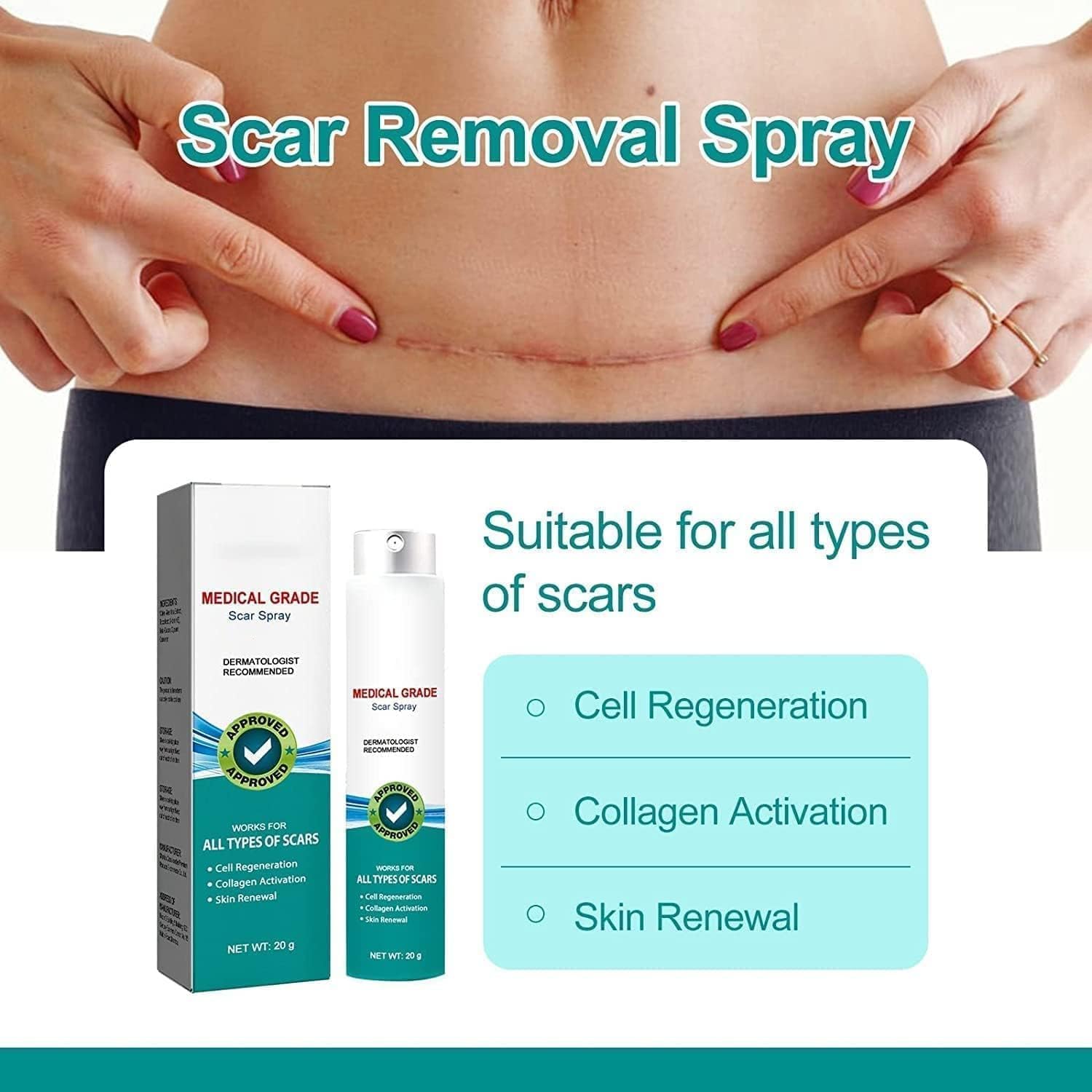 Medical Scar Removal Spray - Crown Cart