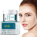 Acne Cream - Crown Cart