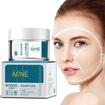 Acne Cream - Crown Cart