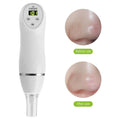 Electric Pore Suction and Acne Removing Device Beauty Cleaner - Crown Cart