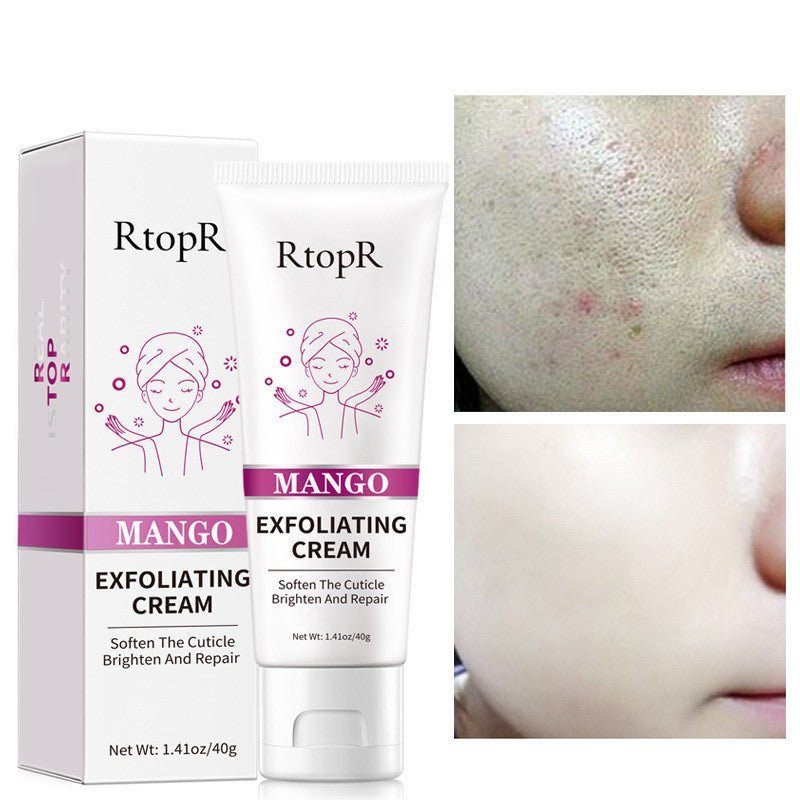 Exfoliating Gel Cream - Crown Cart