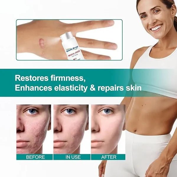 Medical Scar Removal Spray - Crown Cart