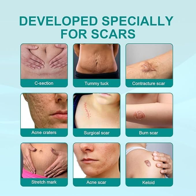 Medical Scar Removal Spray - Crown Cart