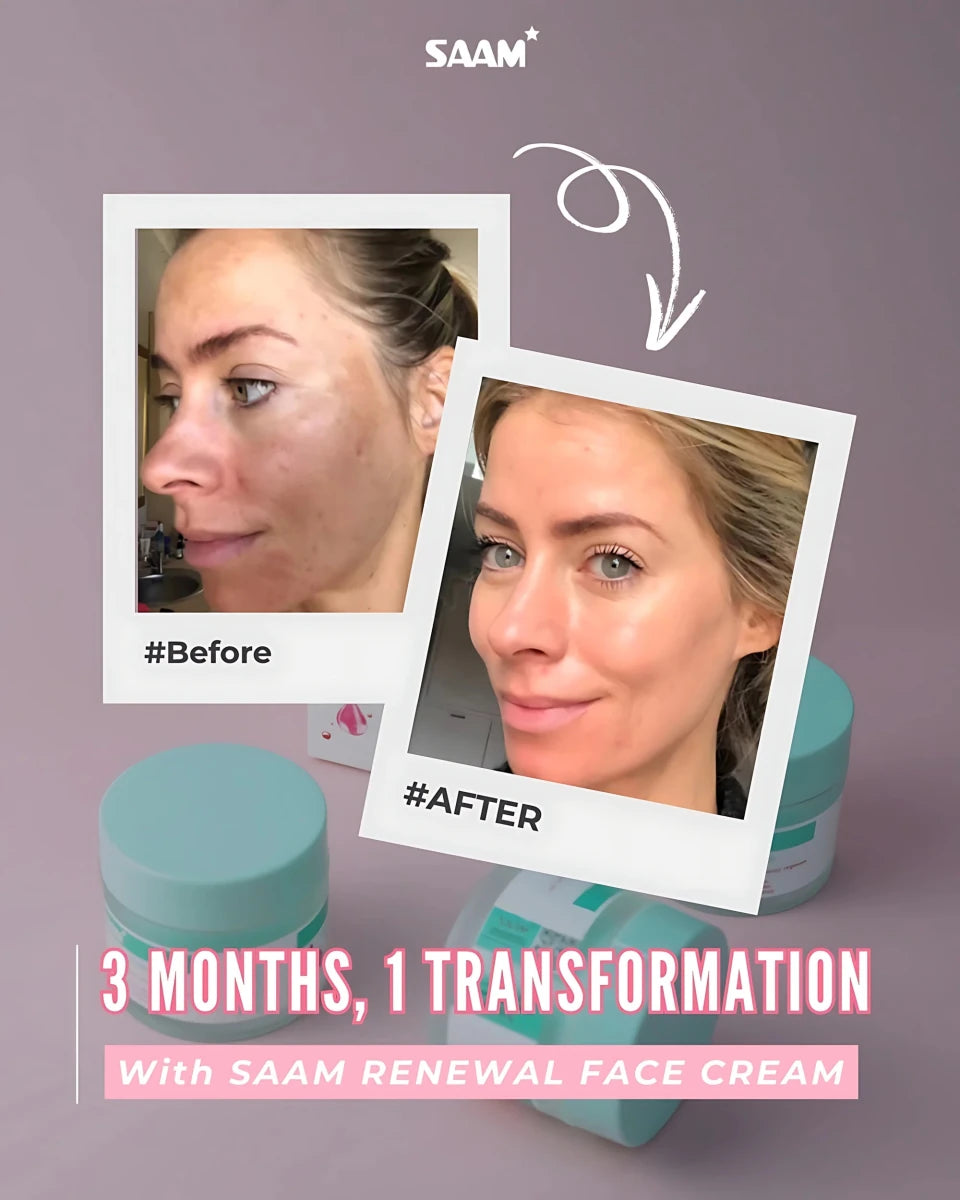 SAAM Renewal Face Cream - Crown Cart