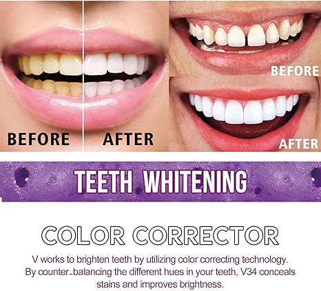 Toothpaste for Teeth Whitening (30ml) - Crown Cart