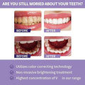 Toothpaste for Teeth Whitening (30ml) - Crown Cart