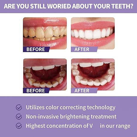 Toothpaste for Teeth Whitening (30ml) - Crown Cart